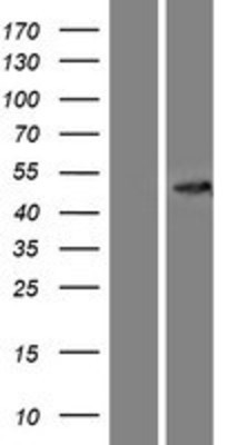 Western Blot: CCBL2 Overexpression Lysate (Adult Normal) [NBP2-11000] Left-Empty vector transfected control cell lysate (HEK293 cell lysate); Right -Over-expression Lysate for CCBL2.