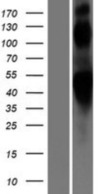 Western Blot: Beta 2 Adrenergic Receptor Overexpression Lysate (Adult Normal) [NBP2-11173] Left-Empty vector transfected control cell lysate (HEK293 cell lysate); Right -Over-expression Lysate for Beta 2 Adrenergic Receptor.