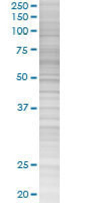 HCK transfected lysate.