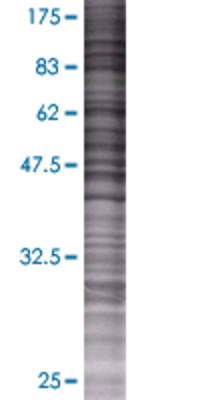 ETS2 transfected lysate.