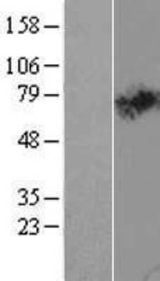 Western Blot: SLC44A2 Overexpression Lysate (Adult Normal) [NBL1-16161] Left-Empty vector transfected control cell lysate (HEK293 cell lysate); Right -Over-expression Lysate for SLC44A2.