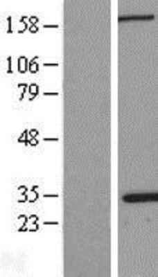 Western Blot: Nucleophosmin Overexpression Lysate (Adult Normal) [NBL1-13748] Left-Empty vector transfected control cell lysate (HEK293 cell lysate); Right -Over-expression Lysate for Nucleophosmin.