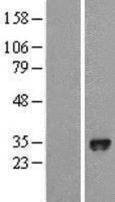 Western Blot: PHD3/HIF Prolyl Hydroxylase 3 Overexpression Lysate (Adult Normal) [NBL1-10156] - Left - Empty vector transfected control cell lysate (HEK293 cell lysate); Right - Over-expression Lysate for HIF Prolyl Hydroxylase 3.