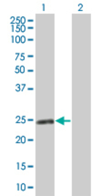 Lane 1: TSPAN8 transfected lysate (26.18 KDa) Lane 2: Non-transfected lysate.