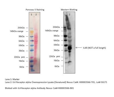 Western Blot: IL4 Receptor alpha Overexpression Lysate (Denatured) [H00003566-T01] - Analysis of IL4 Receptor alpha expression using anti-IL4 Receptor alpha antibody (Cat. # H00003566-B01). Image from verified customer review.