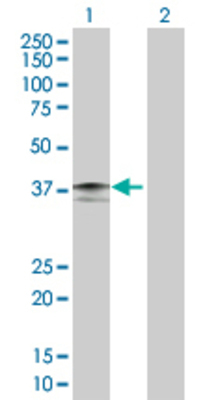 Lane 1: IL4R transfected lysate (25.6 KDa). Lane 2: Non-transfected lysate.