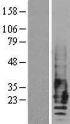 Western Blot: EMP2 Overexpression Lysate (Adult Normal) [NBL1-10260] Left-Empty vector transfected control cell lysate (HEK293 cell lysate); Right -Over-expression Lysate for EMP2.