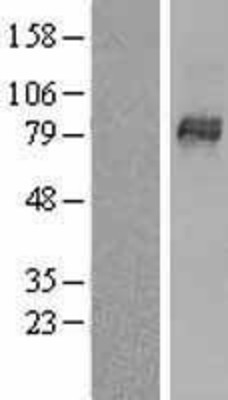Western Blot: OATP8 Overexpression Lysate (Adult Normal) [NBL1-16204] Left-Empty vector transfected control cell lysate (HEK293 cell lysate); Right -Over-expression Lysate for OATP8.