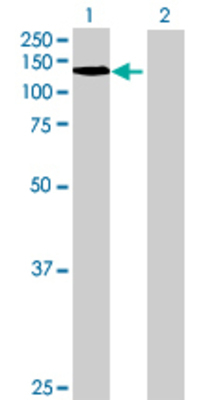 Lane 1: KIF4A transfected lysate (124.08 KDa) Lane 2: Non-transfected lysate.