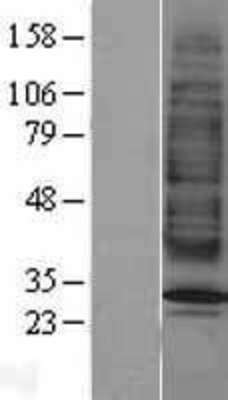 Western Blot: MC2 Receptor Overexpression Lysate (Adult Normal) [NBP2-04160] Left-Empty vector transfected control cell lysate (HEK293 cell lysate); Right -Over-expression Lysate for MC2 Receptor.