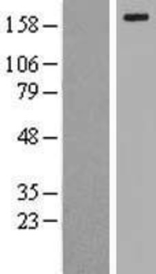 Western Blot: LRP6 Overexpression Lysate (Adult Normal) [NBL1-12672] Left-Empty vector transfected control cell lysate (HEK293 cell lysate); Right -Over-expression Lysate for LRP6.
