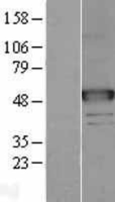 Western Blot: NAGA Overexpression Lysate (Adult Normal) [NBL1-13462] Left-Empty vector transfected control cell lysate (HEK293 cell lysate); Right -Over-expression Lysate for NAGA.
