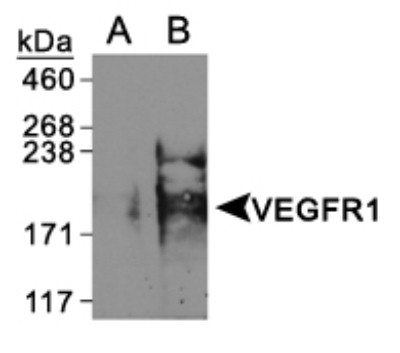 Western Blot: VEGF Receptor 1 Overexpression Lysate [NBL1-06699] - VEGFR1 (A) empty vector control and (B) overexpression lysates [NBL1-06699].