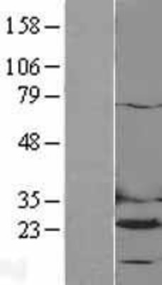 Western Blot: Dihydrofolate reductase Overexpression Lysate (Adult Normal) [NBL1-09860] Left-Empty vector transfected control cell lysate (HEK293 cell lysate); Right -Over-expression Lysate for Dihydrofolate reductase.