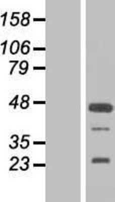Western Blot: FGF19 Overexpression Lysate (Adult Normal) [NBL1-10693] Left-Empty vector transfected control cell lysate (HEK293 cell lysate); Right -Over-expression Lysate for FGF19.