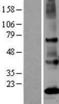 Western Blot: PSGR Overexpression Lysate (Adult Normal) [NBL1-13961] Left-Empty vector transfected control cell lysate (HEK293 cell lysate); Right -Over-expression Lysate for PSGR.