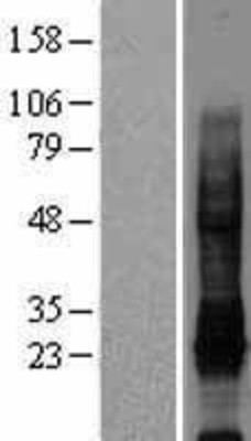 Western Blot: IL32 Overexpression Lysate (Adult Normal) [NBL1-11952] Left-Empty vector transfected control cell lysate (HEK293 cell lysate); Right -Over-expression Lysate for IL32.