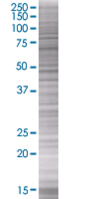 BAG1 transfected lysate