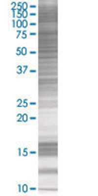 SLC6A4 transfected lysate.