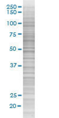 MEF2D transfected lysate.