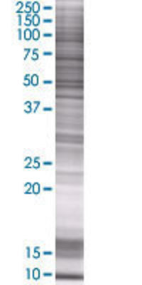 PNPLA3 transfected lysate.