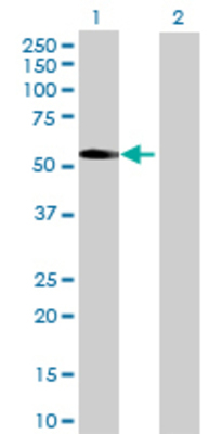 Lane 1: PNPLA3 transfected lysate (53.02 KDa) Lane 2: Non-transfected lysate.