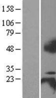 Western Blot: BCMA Overexpression Lysate (Adult Normal) [NBL1-17151] Left-Empty vector transfected control cell lysate (HEK293 cell lysate); Right -Over-expression Lysate for BCMA.