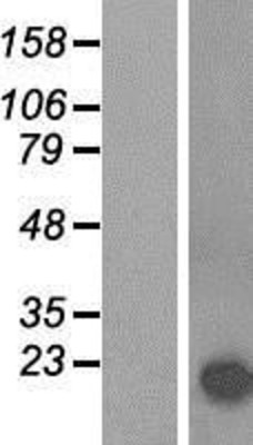 Western Blot: alpha-Synuclein Overexpression Lysate (Adult Normal) [NBP2-11293] Left-Empty vector transfected control cell lysate (HEK293 cell lysate); Right -Over-expression Lysate for alpha-Synuclein.