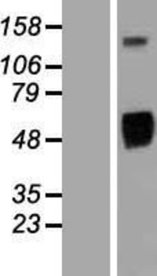 Western Blot: EGFR Overexpression Lysate (Adult Normal) [NBP2-04608] Left-Empty vector transfected control cell lysate (HEK293 cell lysate); Right -Over-expression Lysate for EGFR.
