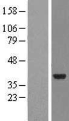 Western Blot: NMNAT2 Overexpression Lysate (Adult Normal) [NBL1-13692] Left-Empty vector transfected control cell lysate (HEK293 cell lysate); Right -Over-expression Lysate for NMNAT2.