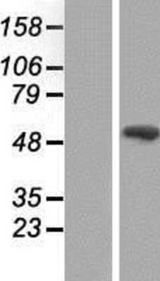 Western Blot: SMAD9 Overexpression Lysate (Adult Normal) [NBP2-07690] Left-Empty vector transfected control cell lysate (HEK293 cell lysate); Right -Over-expression Lysate for SMAD9.