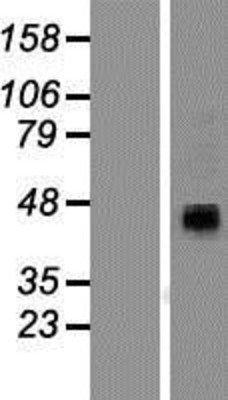 Western Blot: P2RX4 Overexpression Lysate (Adult Normal) [NBP2-08102] Left-Empty vector transfected control cell lysate (HEK293 cell lysate); Right -Over-expression Lysate for P2RX4.