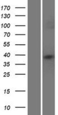 Western Blot: HLA C Overexpression Lysate (Adult Normal) [NBL1-11594] Left-Empty vector transfected control cell lysate (HEK293 cell lysate); Right -Over-expression Lysate for HLA C.