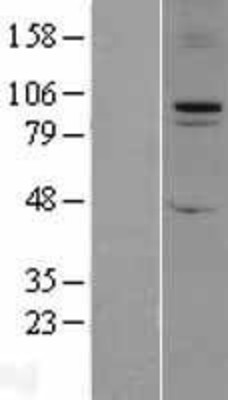 Western Blot: FBXO11 Overexpression Lysate (Adult Normal) [NBL1-10620] Left-Empty vector transfected control cell lysate (HEK293 cell lysate); Right -Over-expression Lysate for FBXO11.
