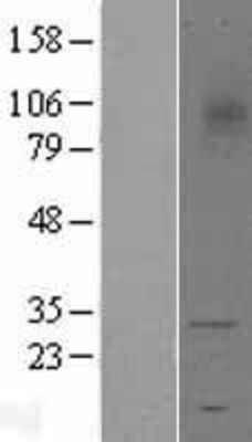 Western Blot: TREM1 Overexpression Lysate (Adult Normal) [NBL1-17264] Left-Empty vector transfected control cell lysate (HEK293 cell lysate); Right -Over-expression Lysate for TREM1.