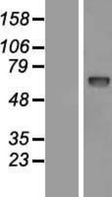 Western Blot: PCSK9 Overexpression Lysate (Adult Normal) [NBL1-14193] Left-Empty vector transfected control cell lysate (HEK293 cell lysate); Right -Over-expression Lysate for PCSK9.