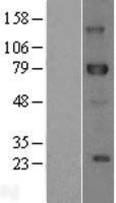 Western Blot: DLL1 Overexpression Lysate (Adult Normal) [NBL1-09914] Left-Empty vector transfected control cell lysate (HEK293 cell lysate); Right -Over-expression Lysate for DLL1.