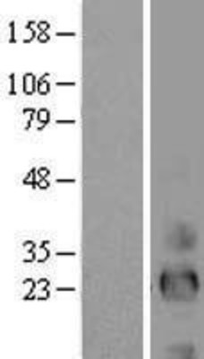 Western Blot: EREG Overexpression Lysate (Adult Normal) [NBL1-10325] Left-Empty vector transfected control cell lysate (HEK293 cell lysate); Right -Over-expression Lysate for EREG.