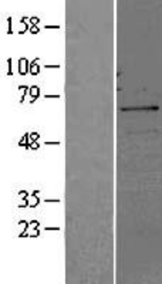 Western Blot: Cdc25B Overexpression Lysate (Adult Normal) [NBL1-08995] Left-Empty vector transfected control cell lysate (HEK293 cell lysate); Right -Over-expression Lysate for Cdc25B.