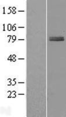 Western Blot: ZBTB22 Overexpression Lysate (Adult Normal) [NBL1-17965] Left-Empty vector transfected control cell lysate (HEK293 cell lysate); Right -Over-expression Lysate for ZBTB22.