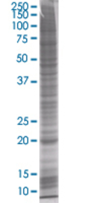 FTH1 transfected lysate
