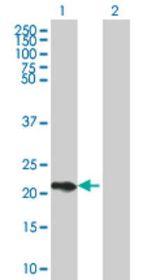 Lane 1: FTH1 transfected lysate (20.24 KDa). Lane 2: Non-transfected lysate.