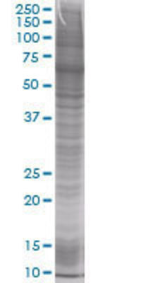 CDA transfected lysate