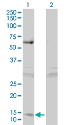 Lane 1: CDA transfected lysate (16.17 KDa). Lane 2: Non-transfected lysate.