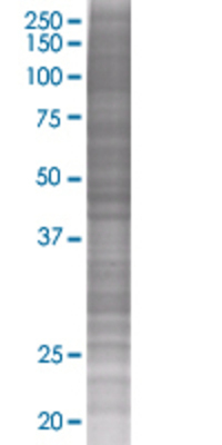 RASD2 transfected lysate