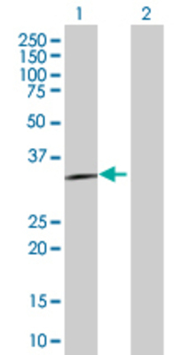 Lane 1: RASD2 transfected lysate (30.4 KDa). Lane 2: Non-transfected lysate.