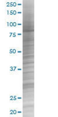 DGKG transfected lysate.