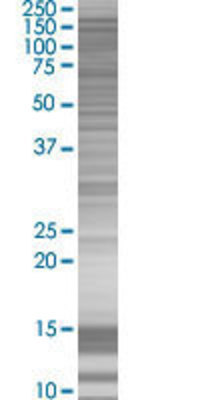 RET transfected lysate.
