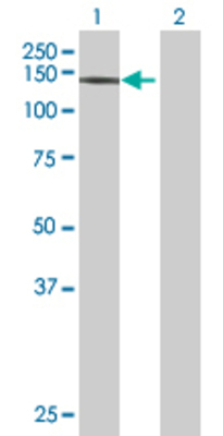 Lane 1: RET transfected lysate (119.8 KDa) Lane 2: Non-transfected lysate.