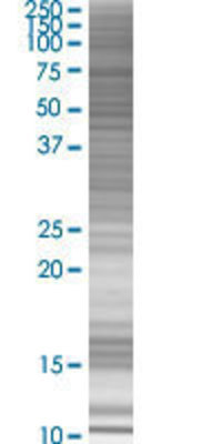 HDAC10 transfected lysate.